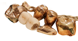 Zahngold
